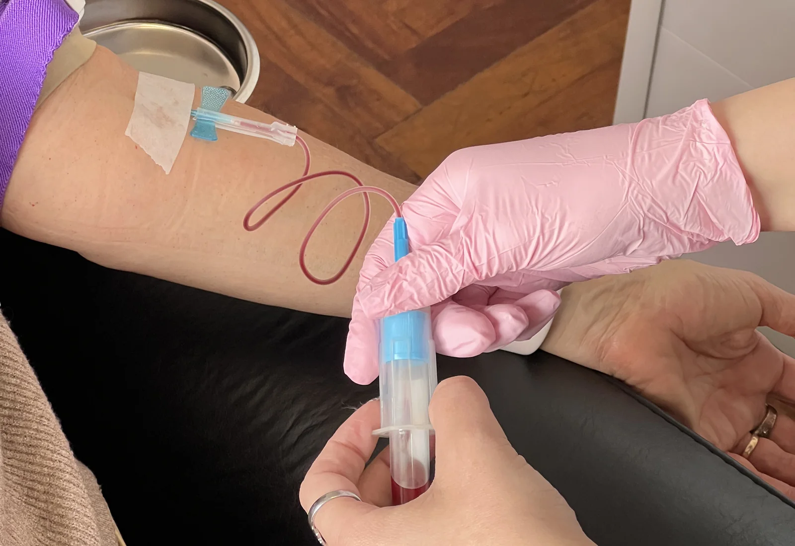 Plasma Rico en Plaquetas Capilar en JF Skin & Hair Studio